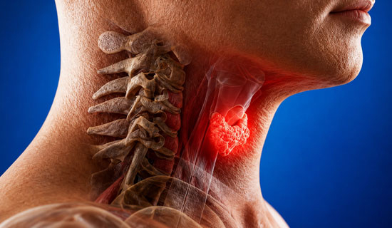 Thyroid Cancer Treatment